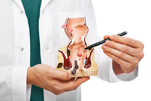 Fissure surgery