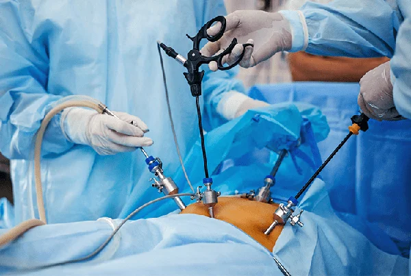 Laparoscopic GI Surgery